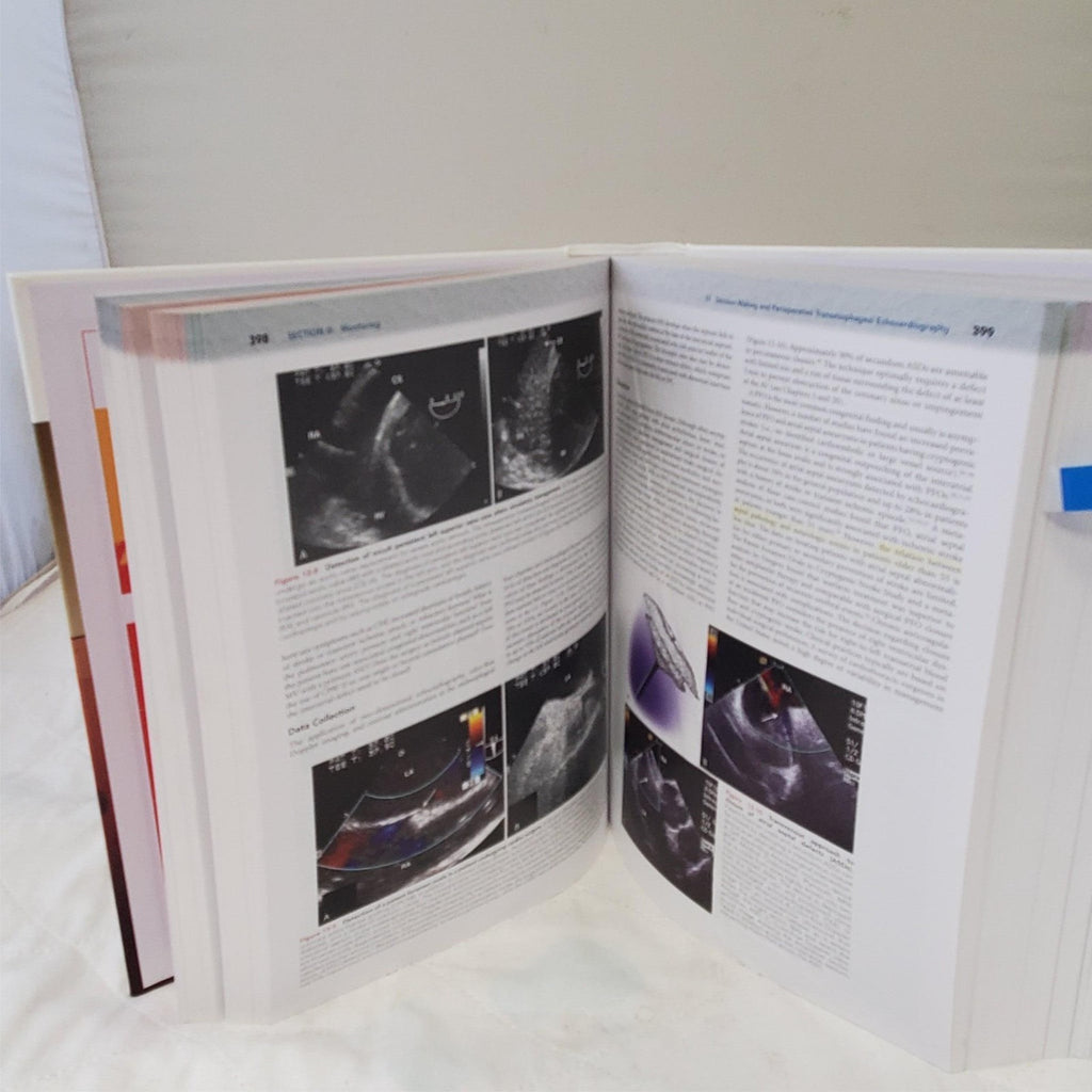 Kaplan's Cardiac Anesthesia The Echo Era Sixth Edition by Joel A. Kaplan
